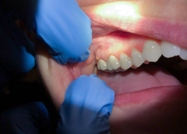 Best Emergency Denture Repair in Central City, PA