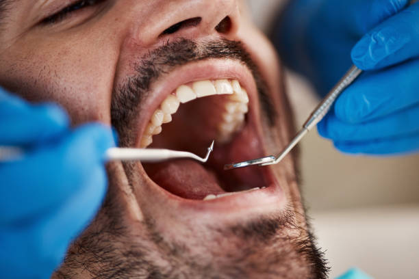 Best Urgent Care for Lost Fillings or Crowns in Central City, PA